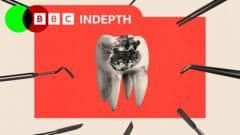 Can Labour's Dental Reforms Save a Crumbling NHS Dentistry System?