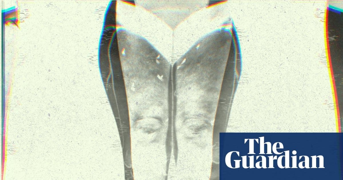 Lipedema: The Painful, Misunderstood Condition Silently Affecting Millions of Women