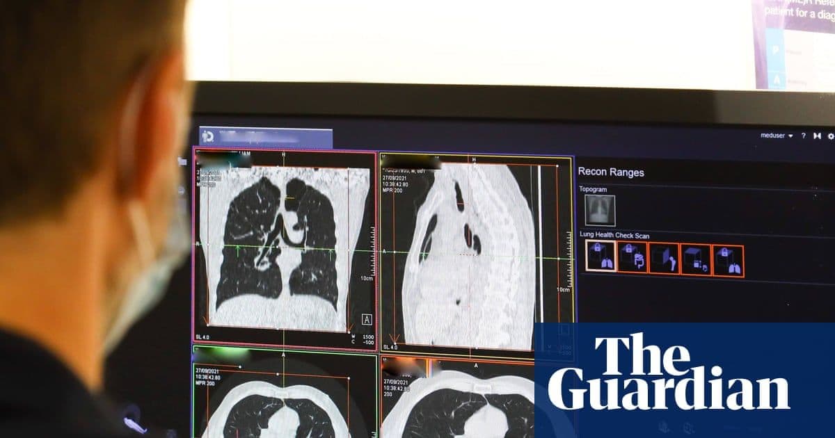 NHS Shells Out Record £241 Million to Private Companies for Scan Analysis as Staffing Crisis Deepens