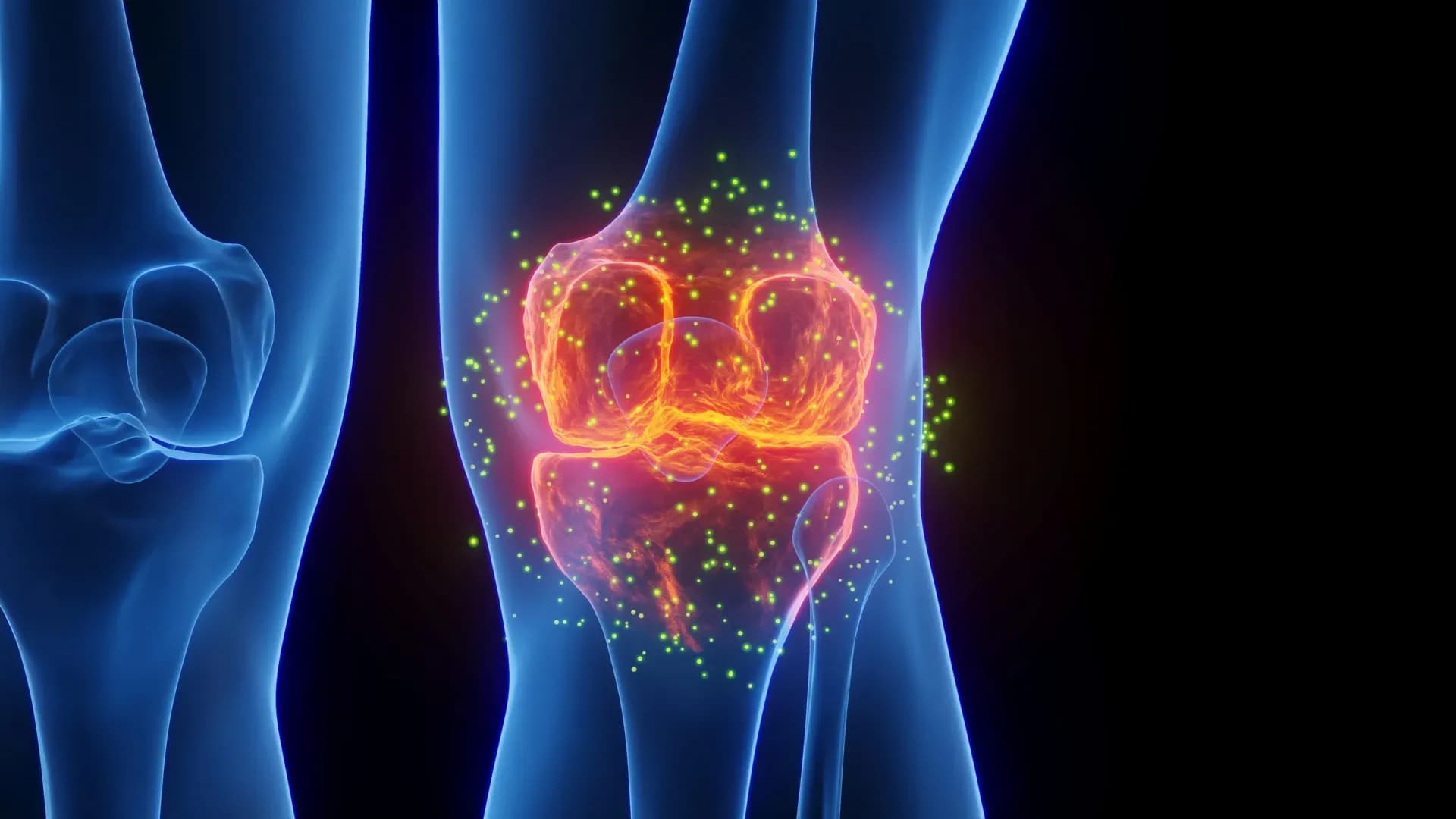Goodbye Knee Replacement? This Minimally Invasive Procedure Is Changing Pain Management