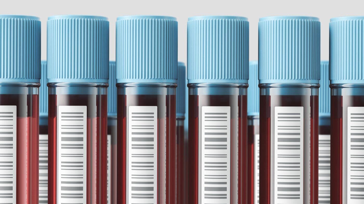 DIY Blood Testing Is Booming — But Can You Really Interpret the Results?
