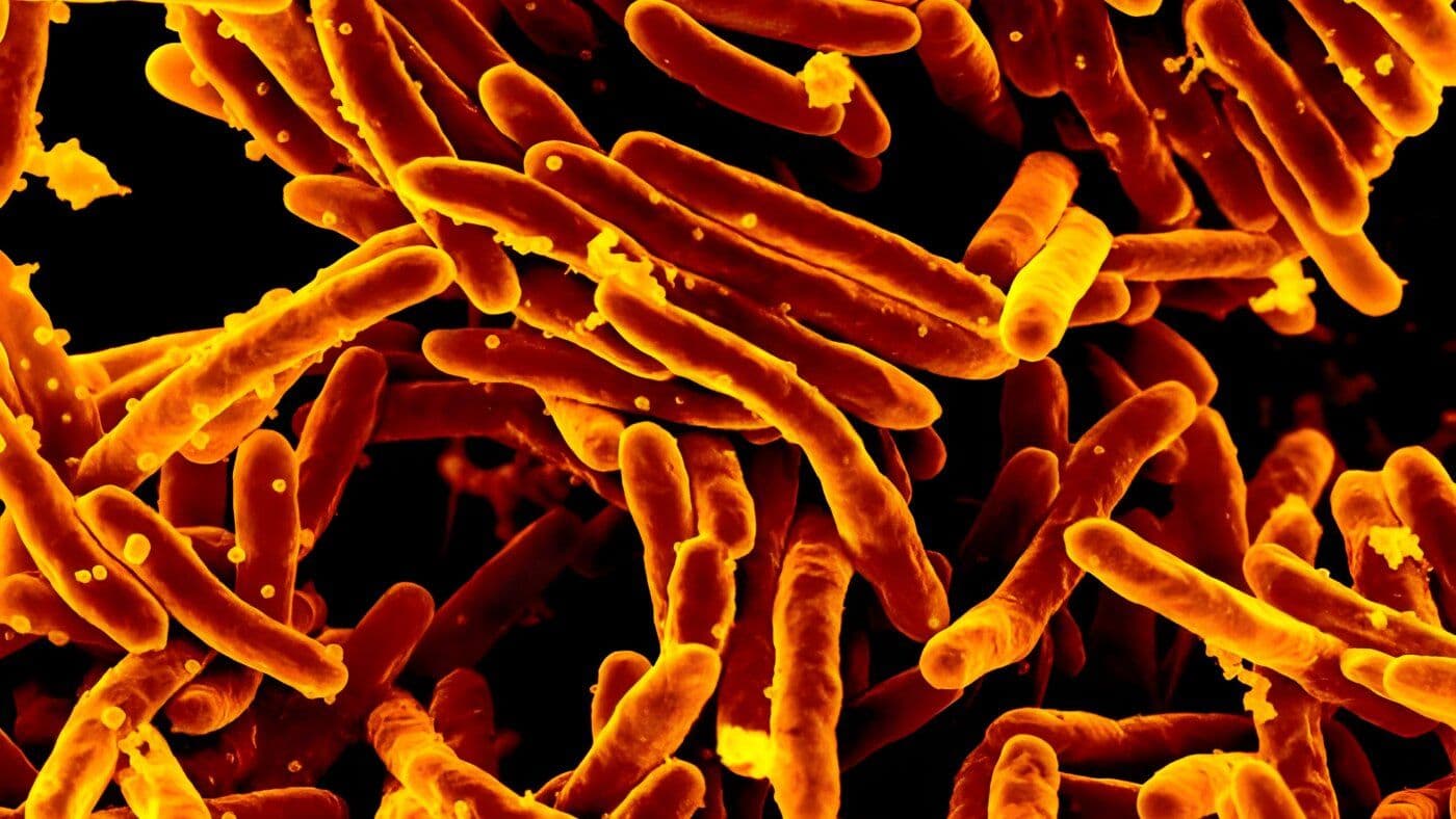 Revolutionary TB Test Delivers Results in Under 30 Minutes — No Phlegm Required