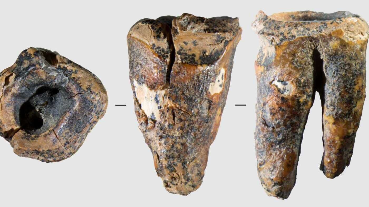 Ancient Dentistry? Neanderthals May Have Performed Cavity Drilling 59,000 Years Ago