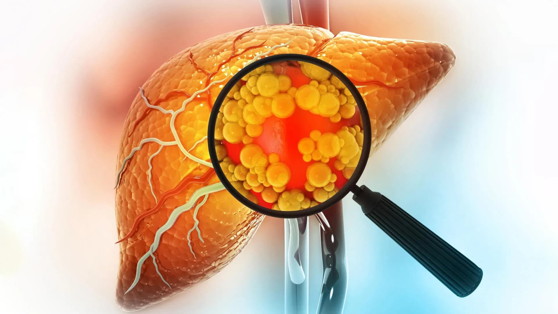 UCLA Scientists Eliminate 'Zombie' Immune Cells and Reverse Liver Damage in Mice