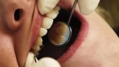 Australian Health Authorities Warn Thousands of Dental Patients to Get Tested for HIV and Hepatitis