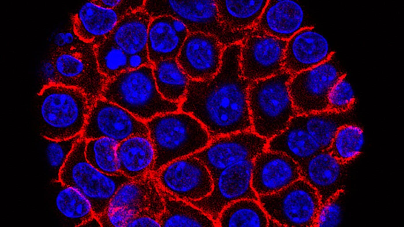 Breakthrough Pill Doubles Survival Time for Advanced Pancreatic Cancer Patients