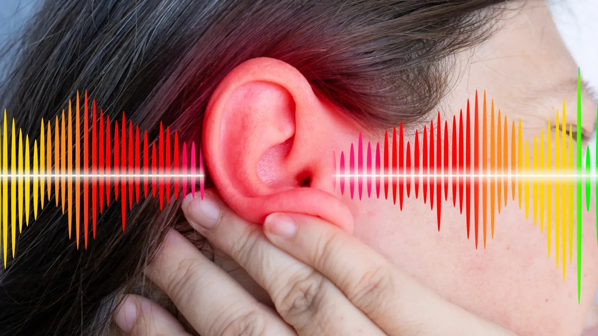 Serotonin's Dark Side: How the Brain's 'Happy Chemical' May Be Making Tinnitus Worse